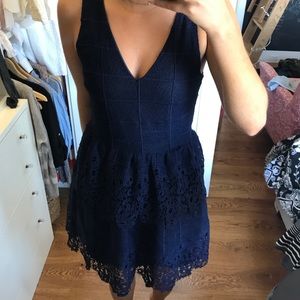 Francesca’s Lace Dress